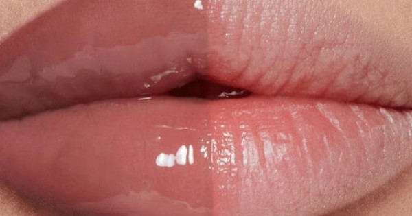 Lip Maximizer