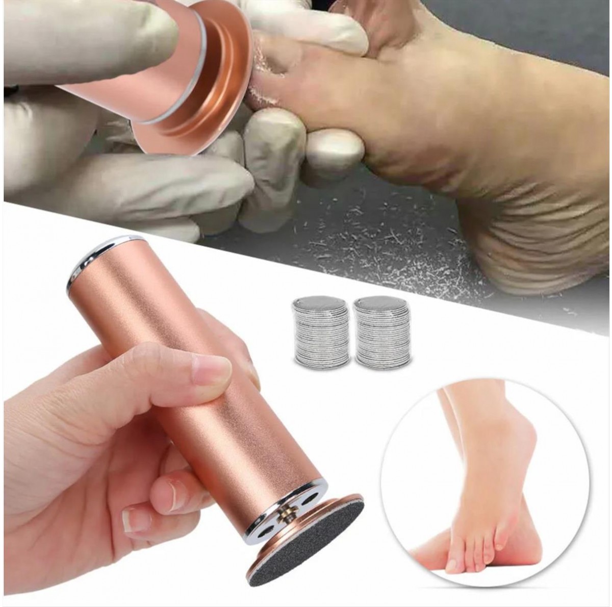 Ηλεκτρική Ράσπα Electric Foot Callus Remover CJ-DM001