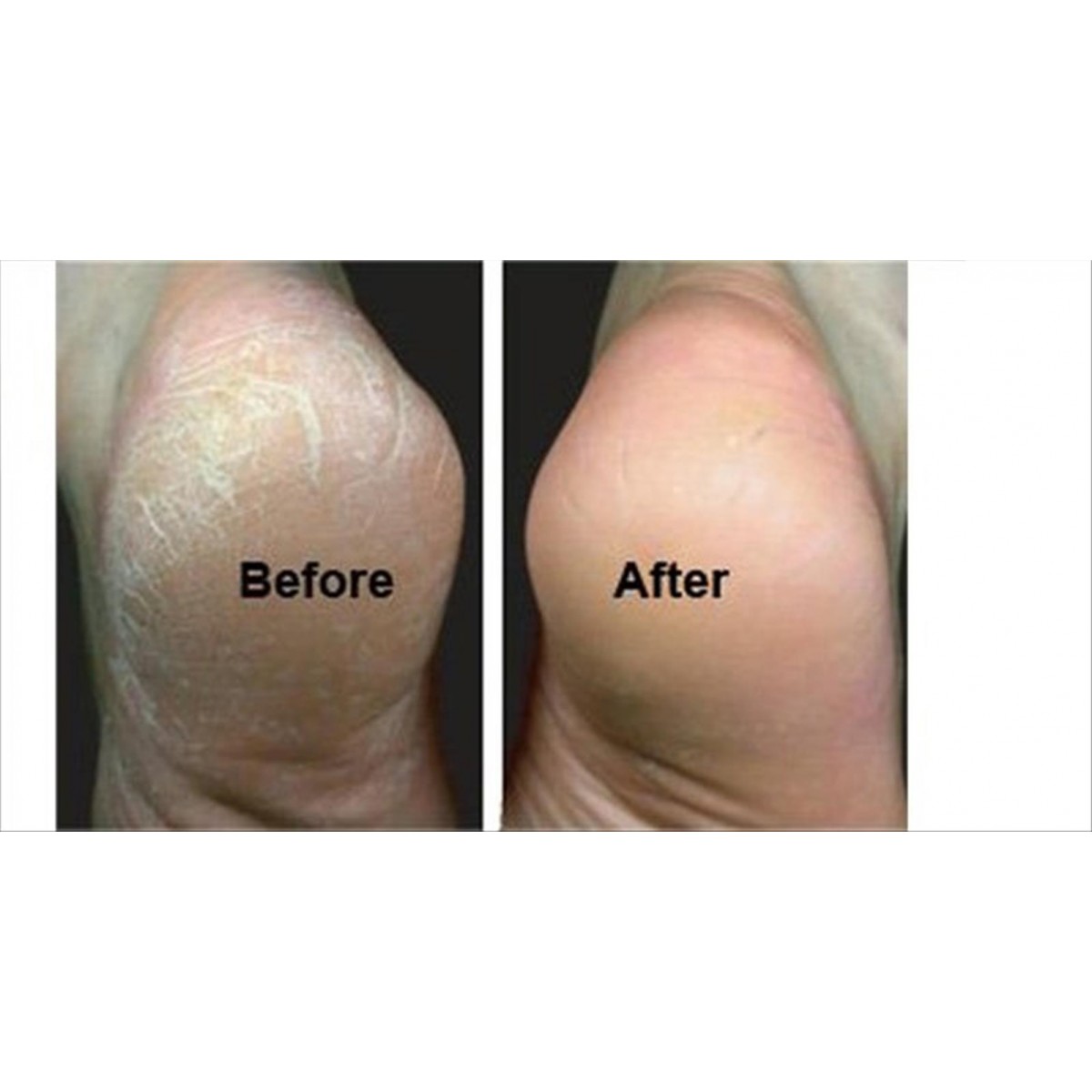 Keratolytic L΄opal Lotion 1000ml