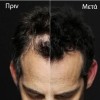 Toppik Ίνες Κερατίνης Αραίωσης Μαλλιών 12γρ.
