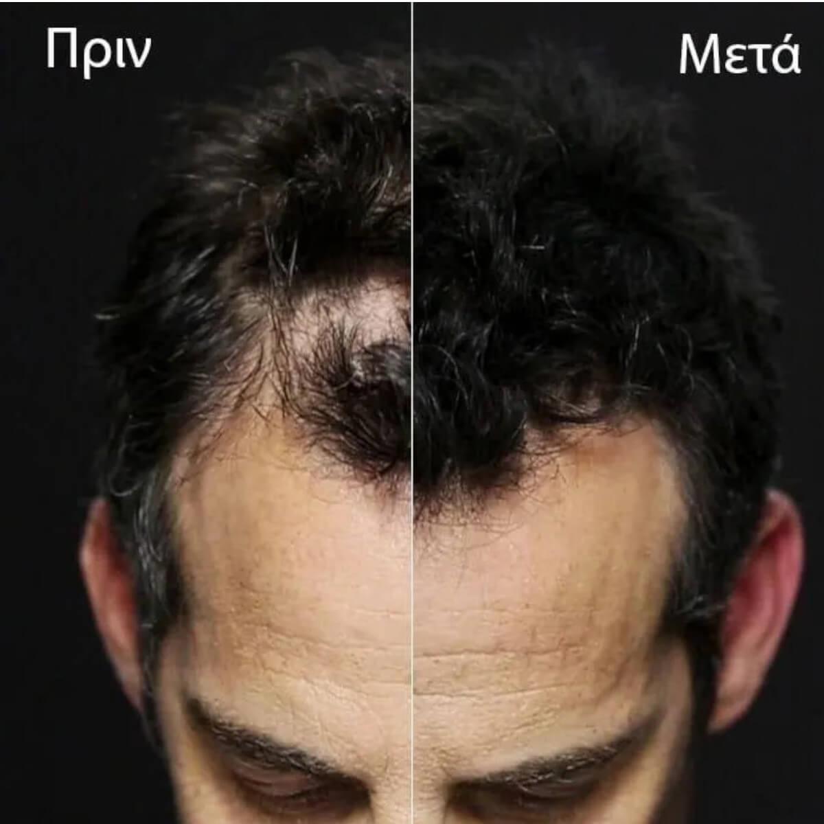 Toppik Ίνες Κερατίνης Πύκνωσης Μαλλιών 27.5γρ