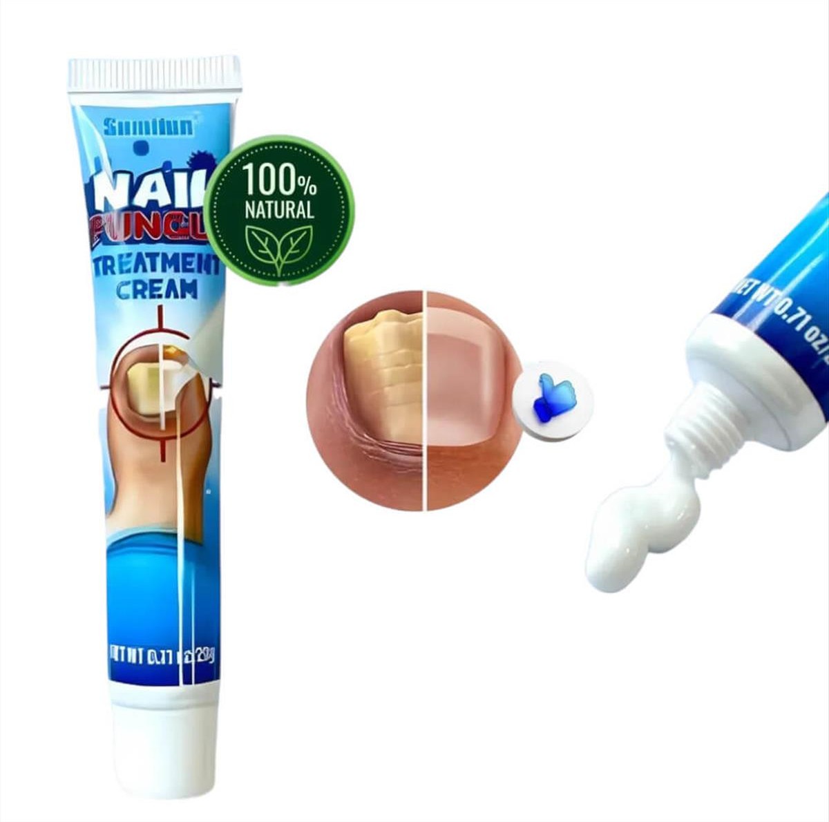 Κρέμα για μύκητες νυχιών Sumifun Nail Fungus 20g