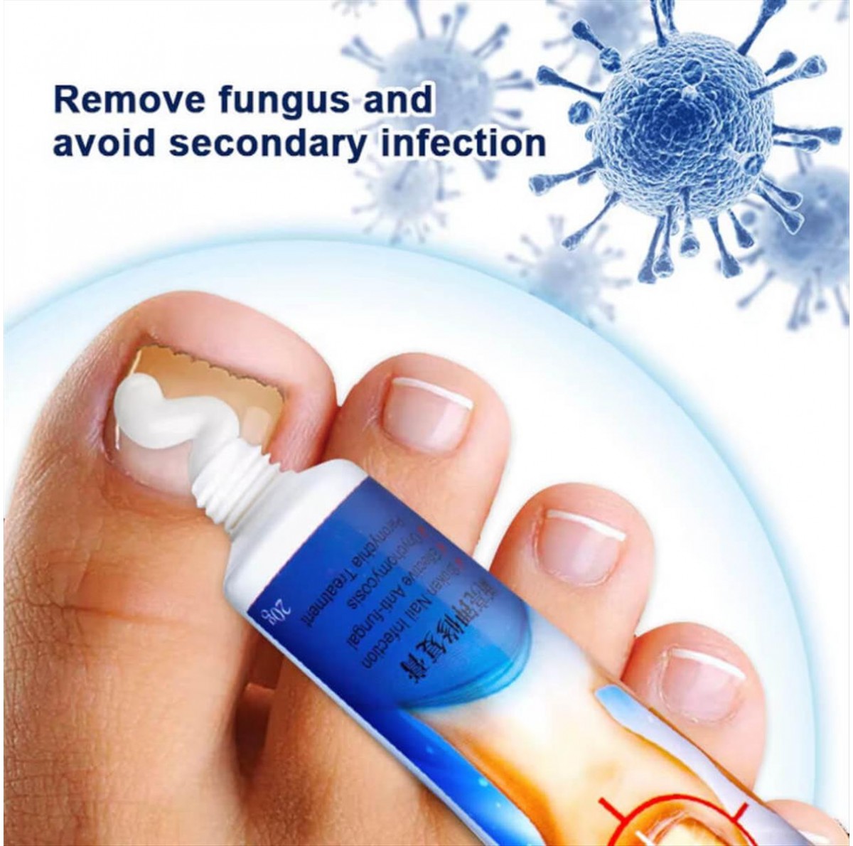 Κρέμα για μύκητες νυχιών Sumifun Nail Fungus 20g