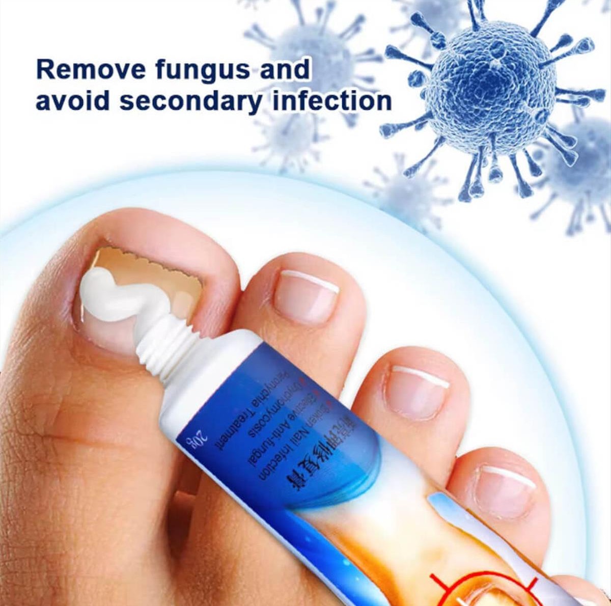 Κρέμα για μύκητες νυχιών Sumifun Nail Fungus 20g
