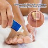 Κρέμα για μύκητες νυχιών Sumifun Nail Fungus 20g