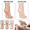Cosmofan Callus Remover 16cm