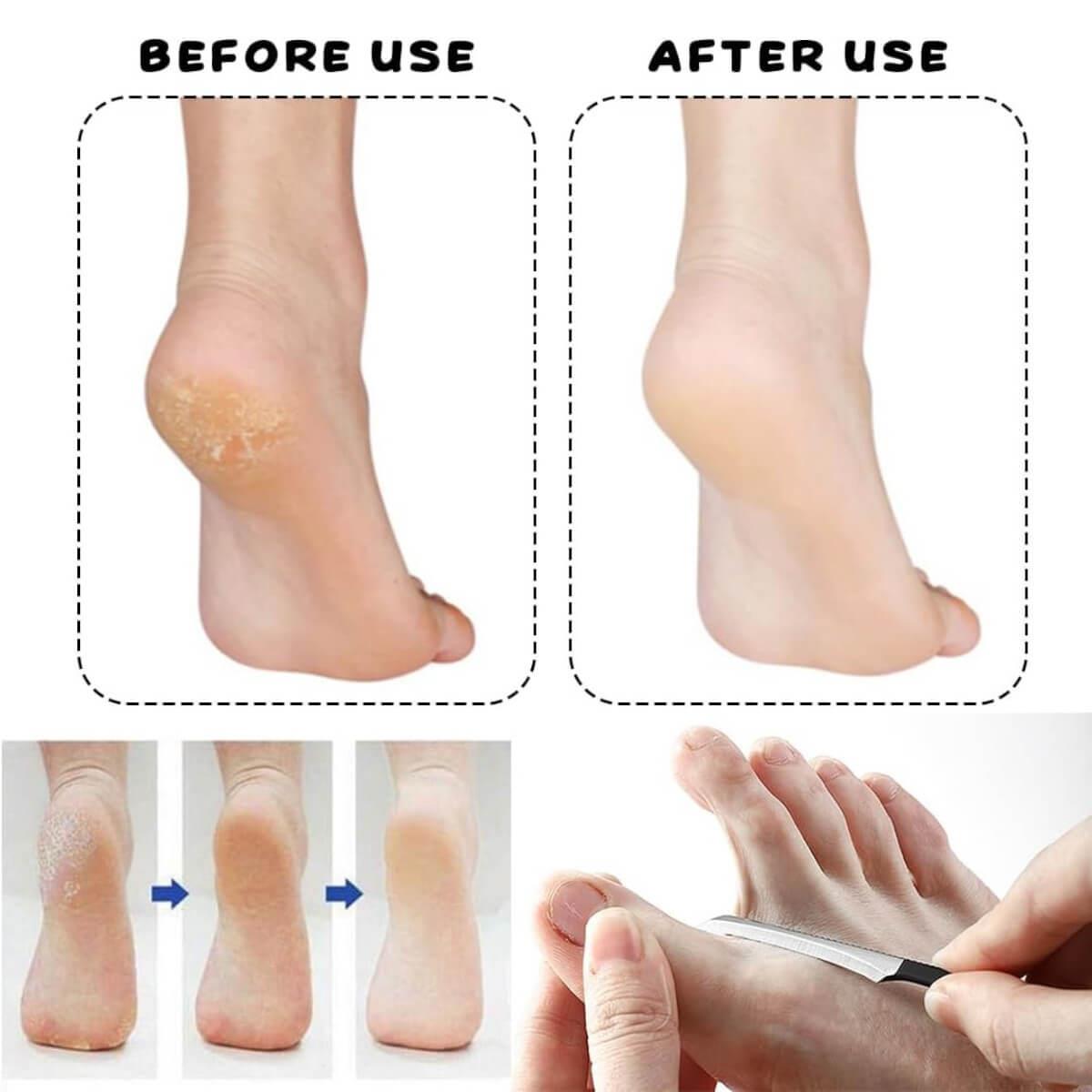 Cosmofan Callus Remover 16cm