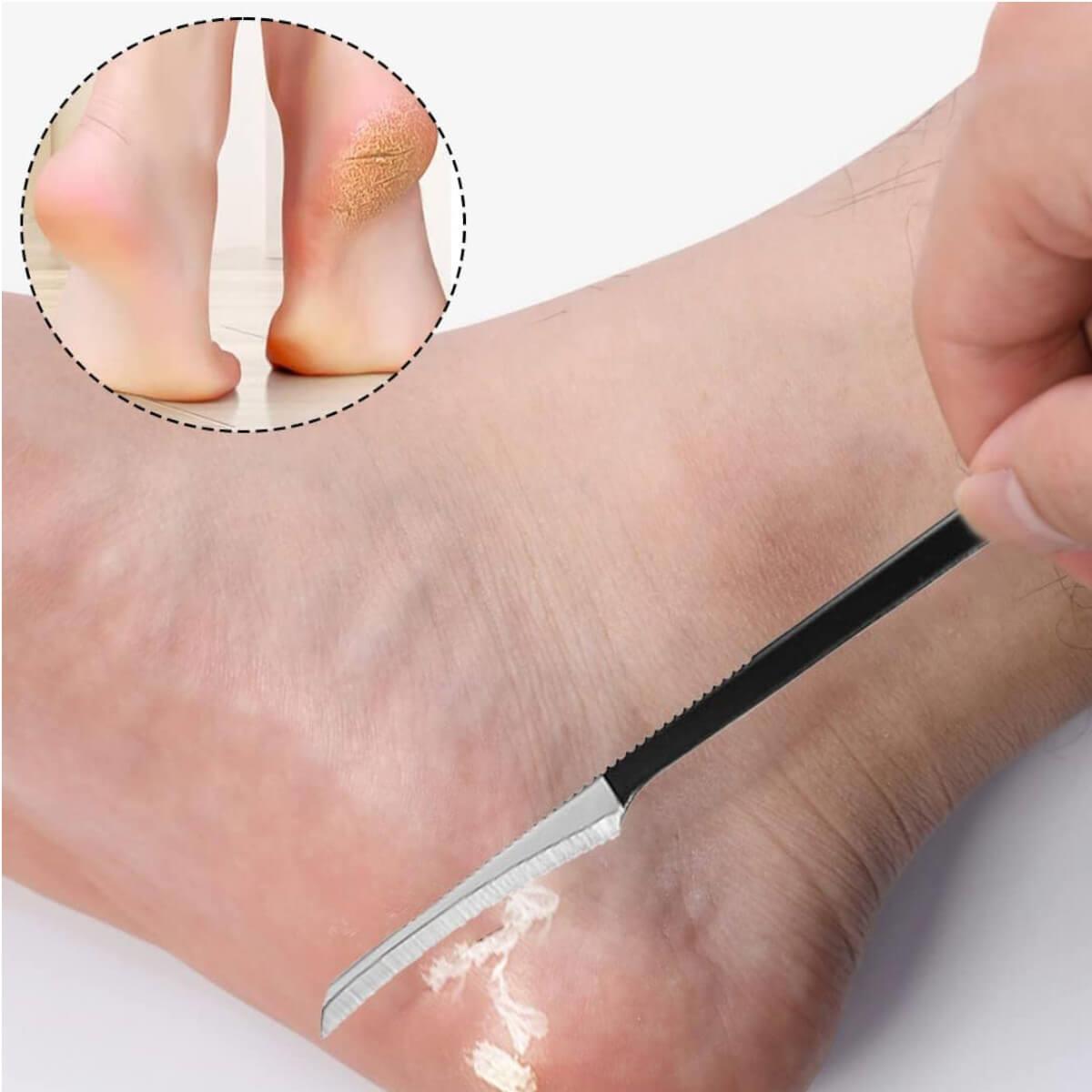 Cosmofan Callus Remover 16cm
