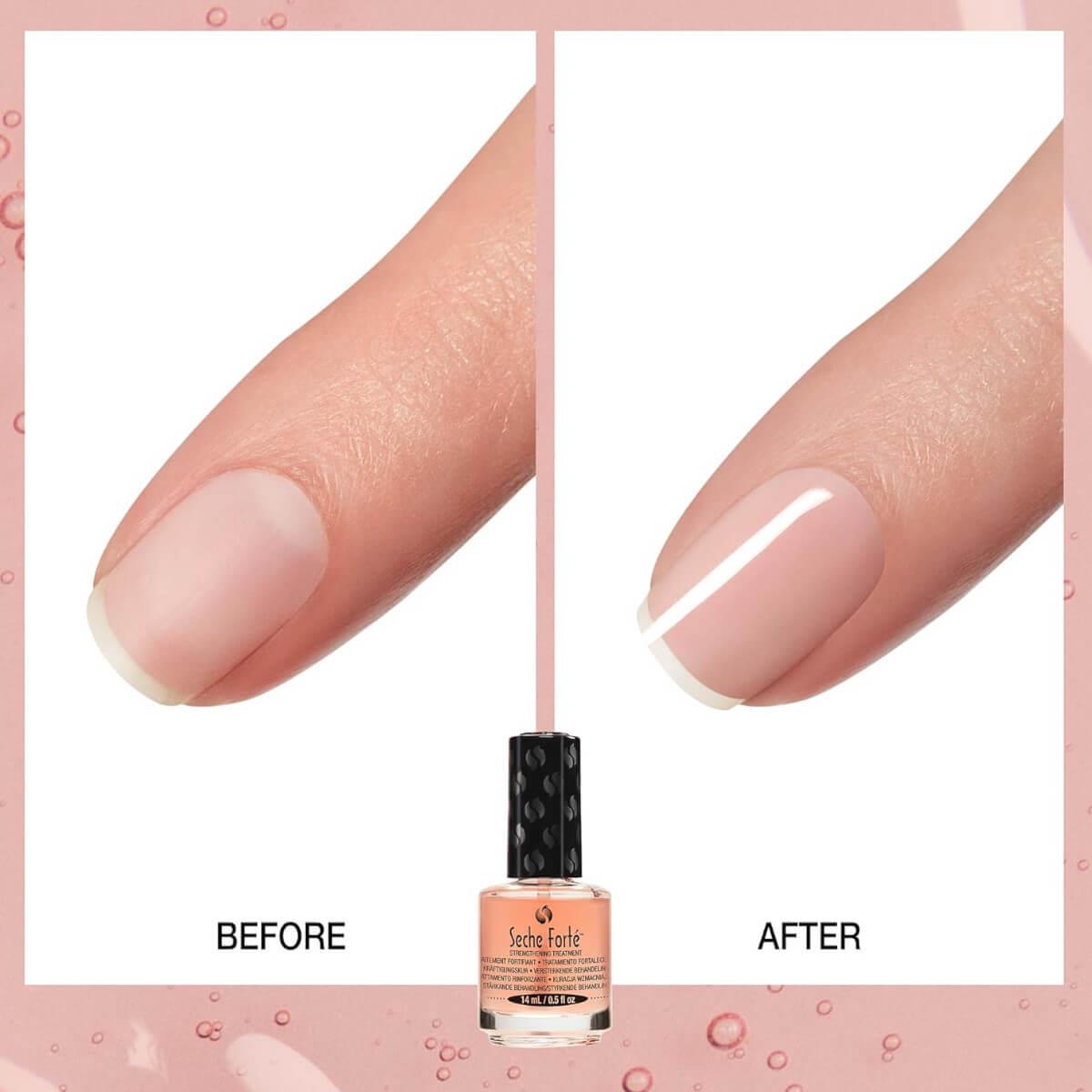 Forte Strengthening Treatment Base Coat 14ml Seche