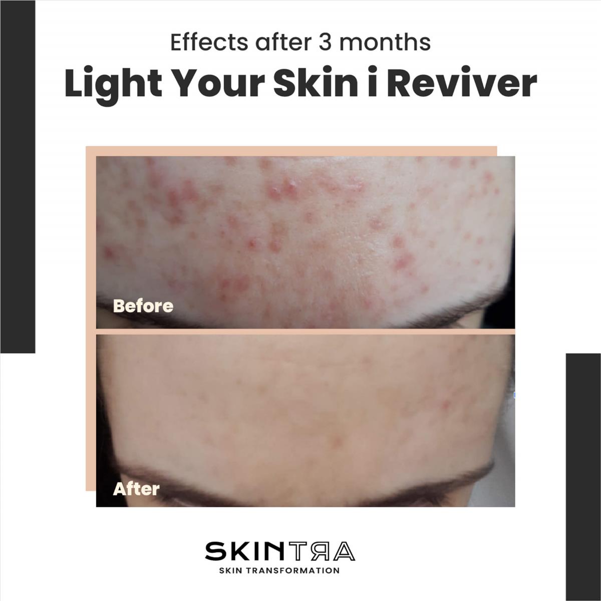 Serum vitamin C 20% and ferulic acid 30ml Skintra