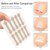 Nail Protection Adhesive Patches 100pcs