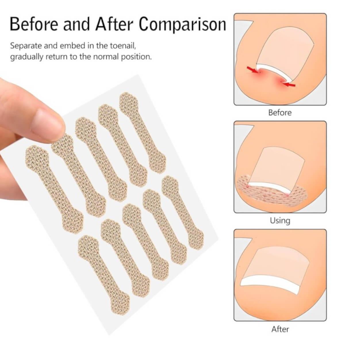 Nail Protection Adhesive Patches 100pcs