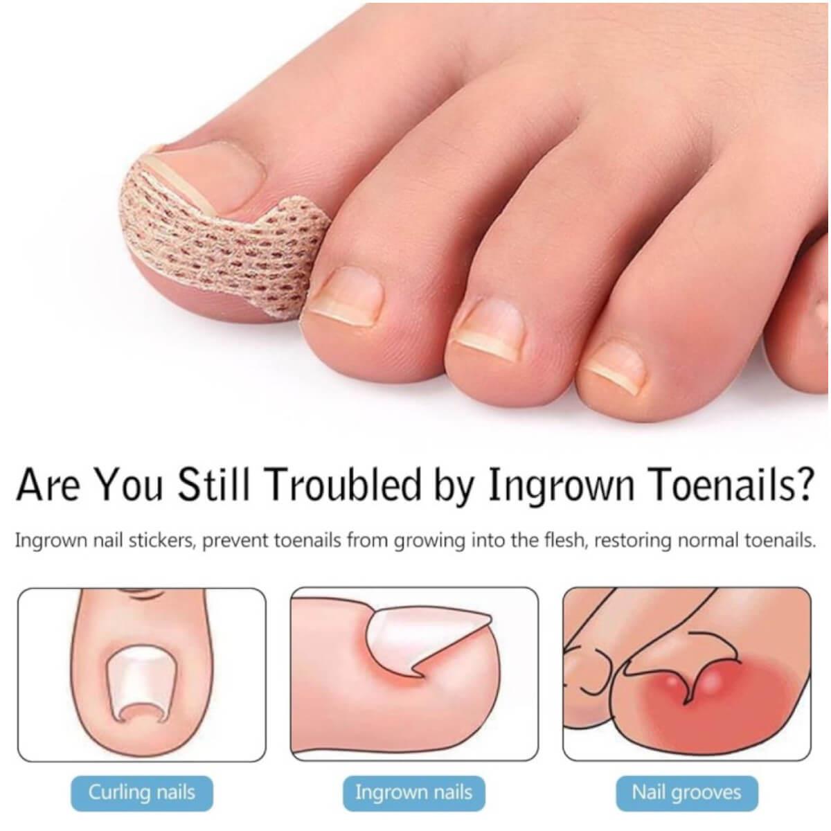 Nail Protection Adhesive Patches 100pcs