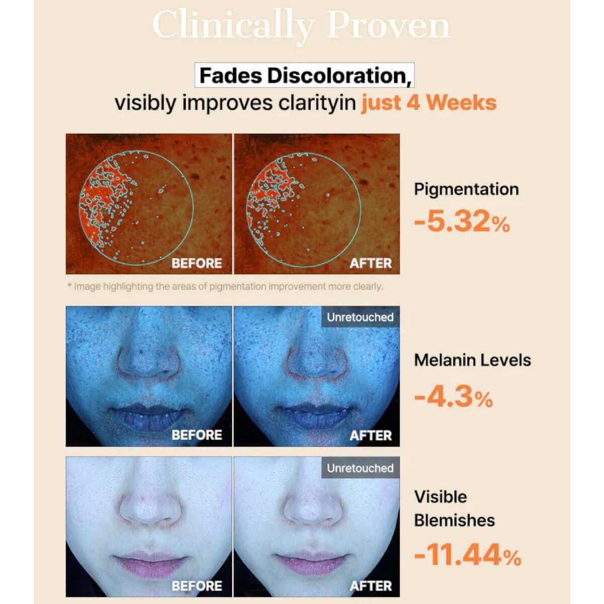 The alpha arbutin discoloration care hydrogel mask 34g Cosrx