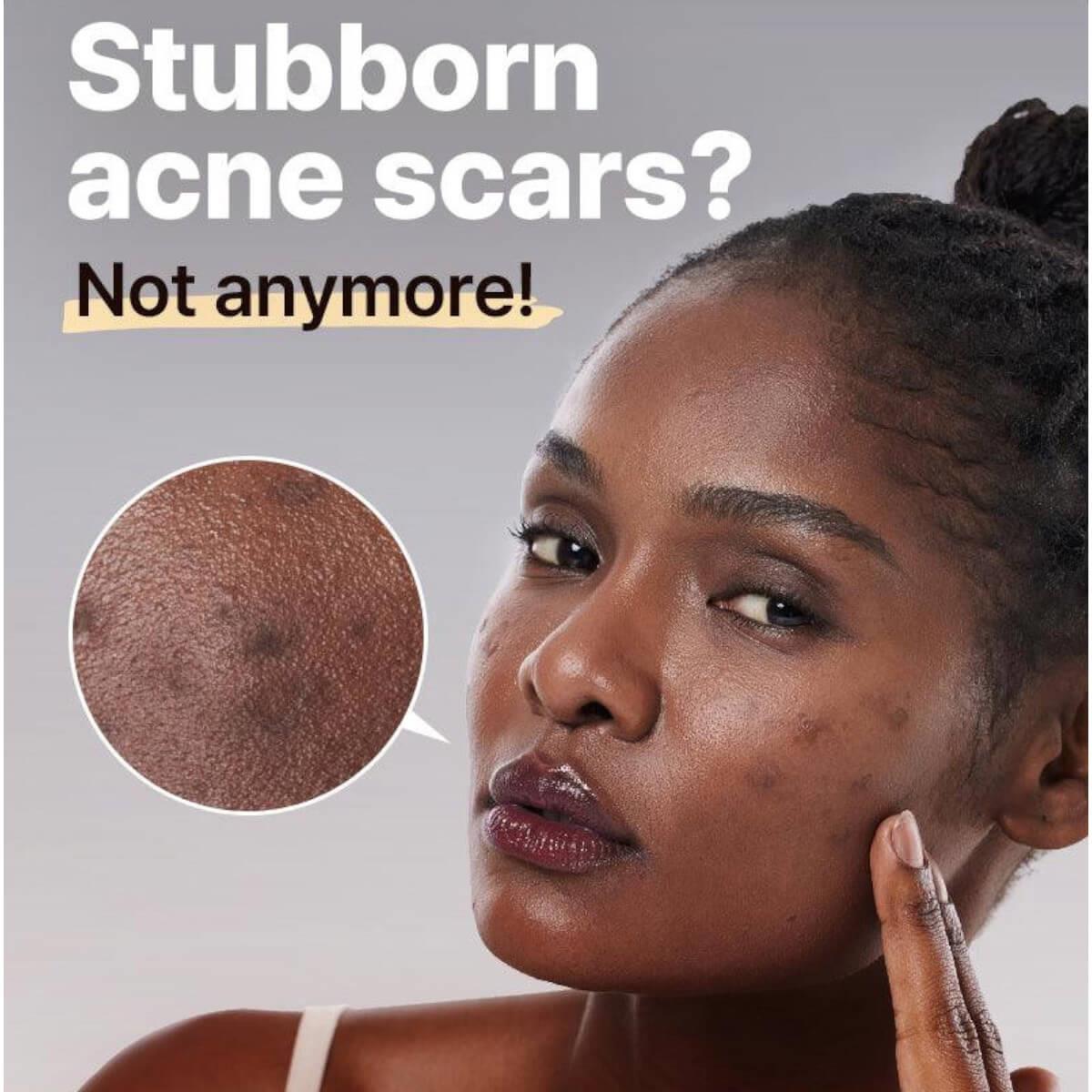 The alpha arbutin 2 discoloration care serum 50ml Cosrx