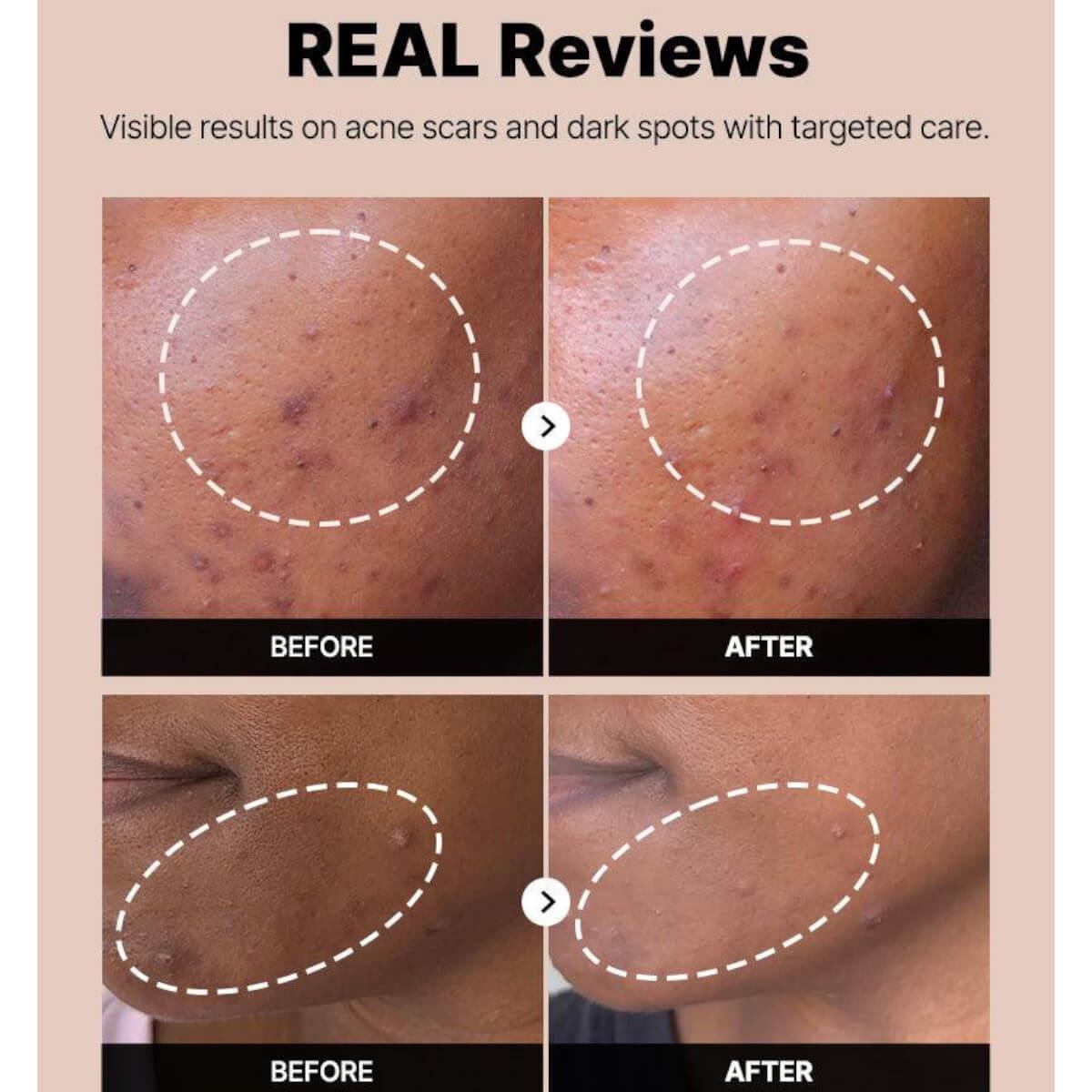 The alpha arbutin 2 discoloration care serum 50ml Cosrx