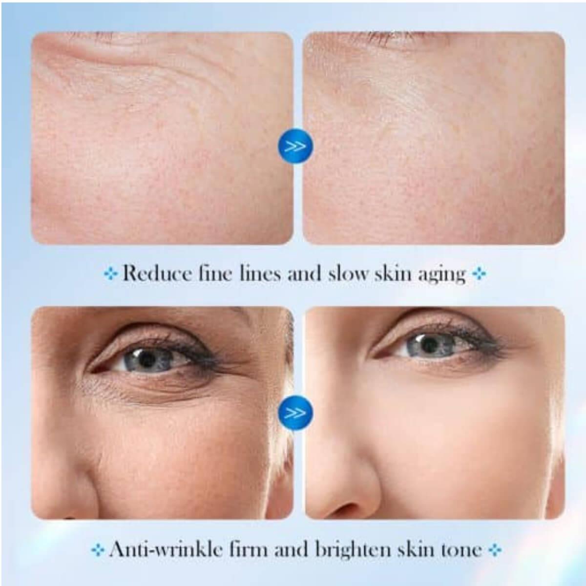 Σετ αμπούλες αντιγήρανσης και επανόρθωσης  8D Hyaluronic acid 28pcs Sadoer