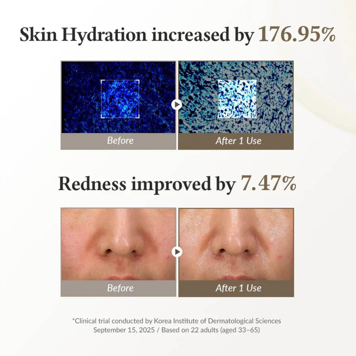 345 relief cream mask 25gr 1pcs Dr.Althea