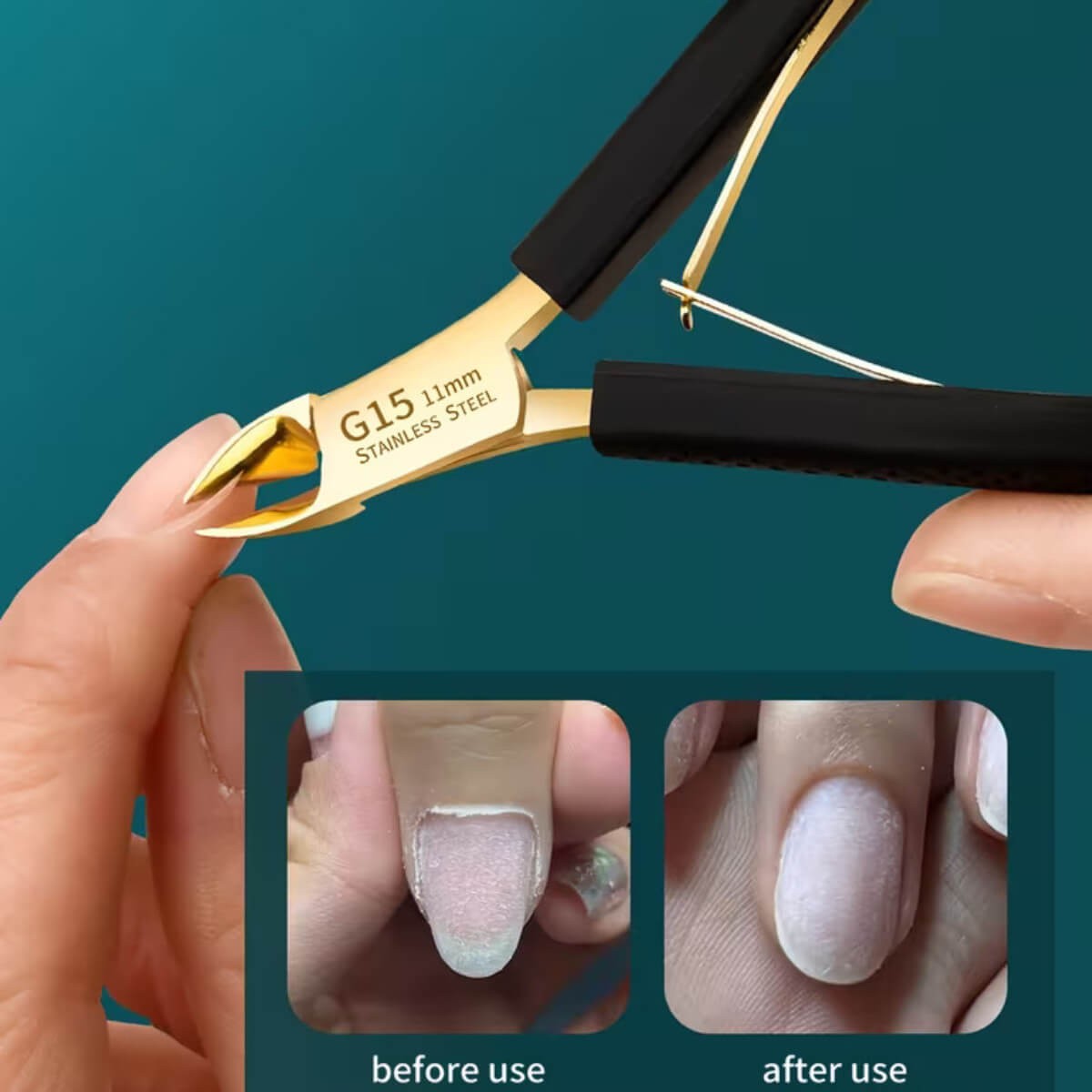 Κόφτης Ονυχοπλαστικής G15 GlobalNail 11mm