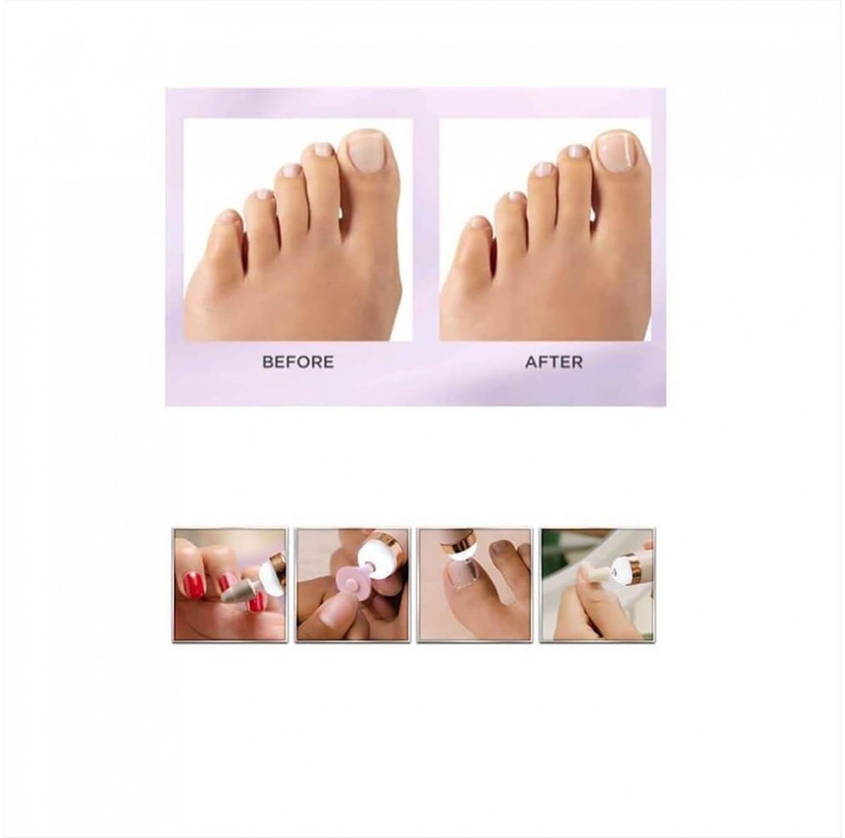 Τροχός Oνυχοπλαστικής Nail Master 35w