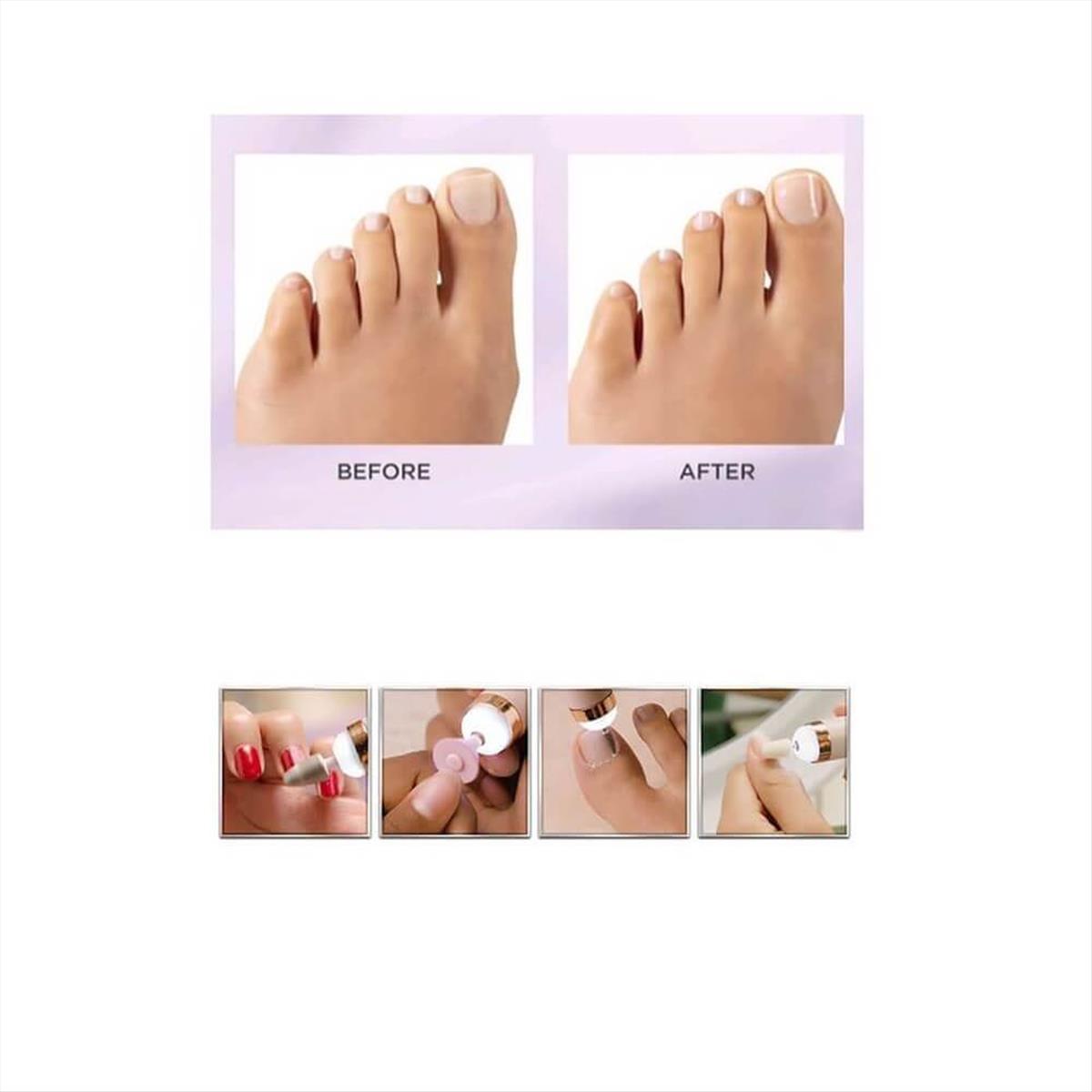 Τροχός Oνυχοπλαστικής Nail Master 35w