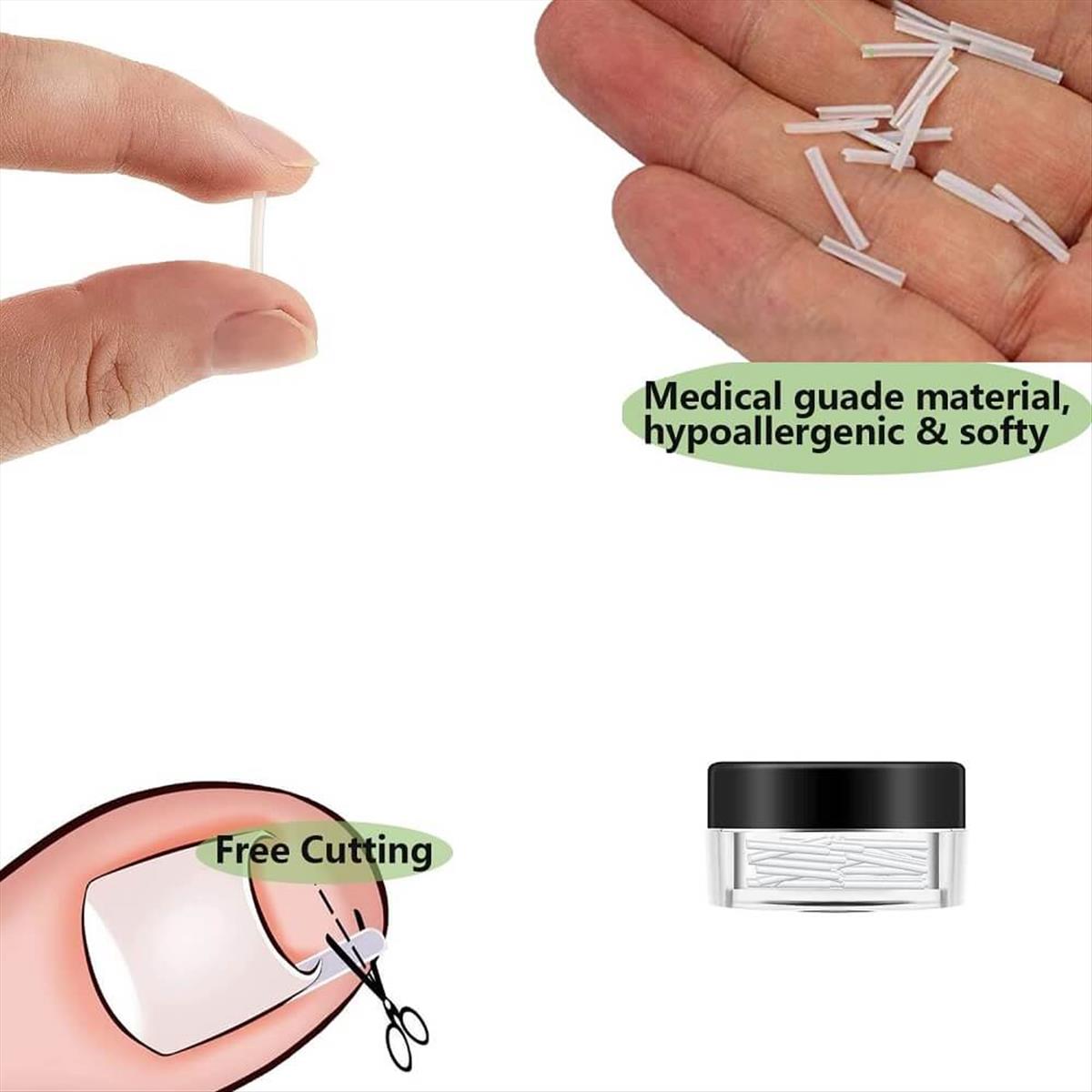 Ingrown Toenail Correction Liner